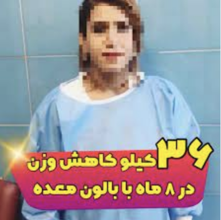 ایا بالون معده خطرناک است؟ ۱۰ عارضه رایج پس از بالن معده