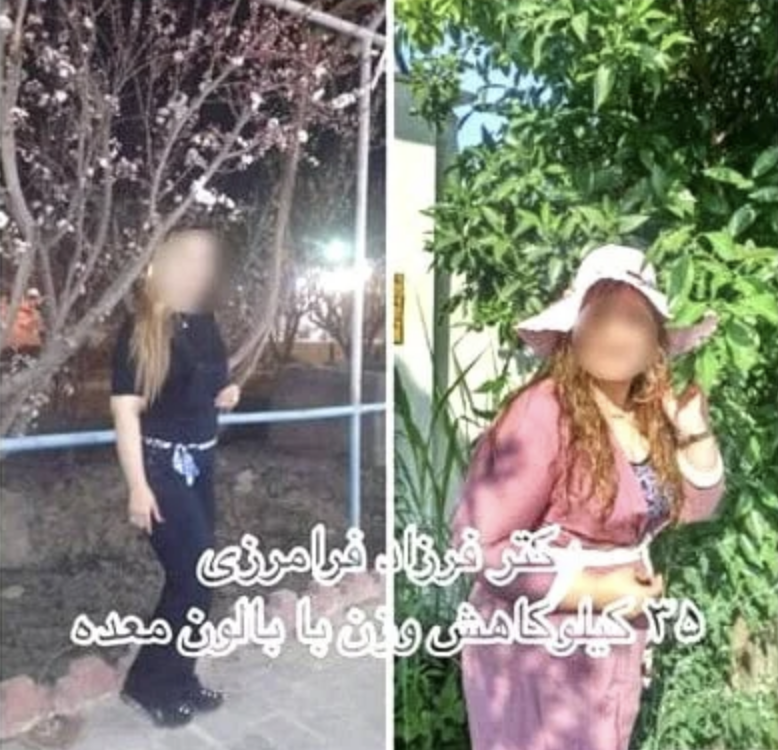 از بالن معده راضی بودین؟ جواب ۱ بیمار دکتر فرزاد فرامرزی را در ادامه بخوانید